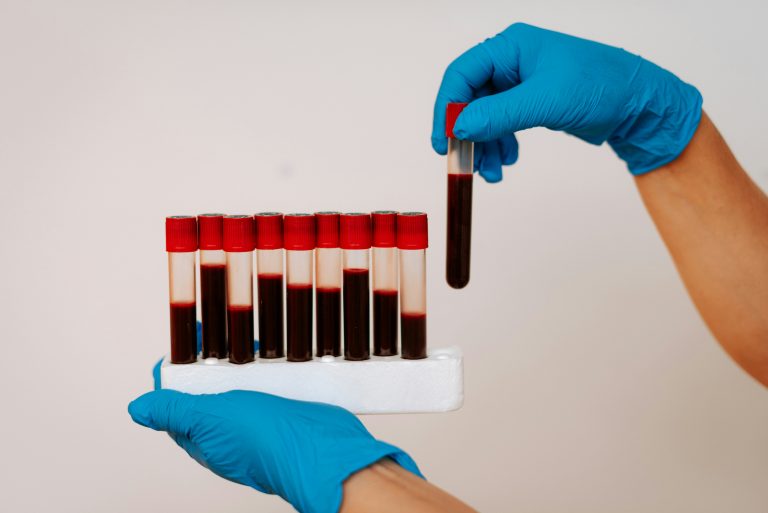 Why Your Doctor Said Your Labs Are Normal (But You Feel Awful)